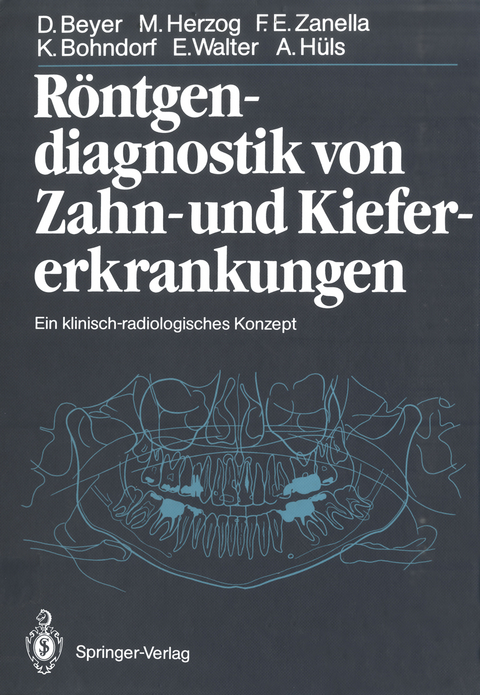 Röntgendiagnostik von Zahn- und Kiefererkrankungen - Dieter Beyer, Michael Herzog, Friedhelm Zanella, Klaus Bohndorf, Eberhard Walter, Alfons Hüls