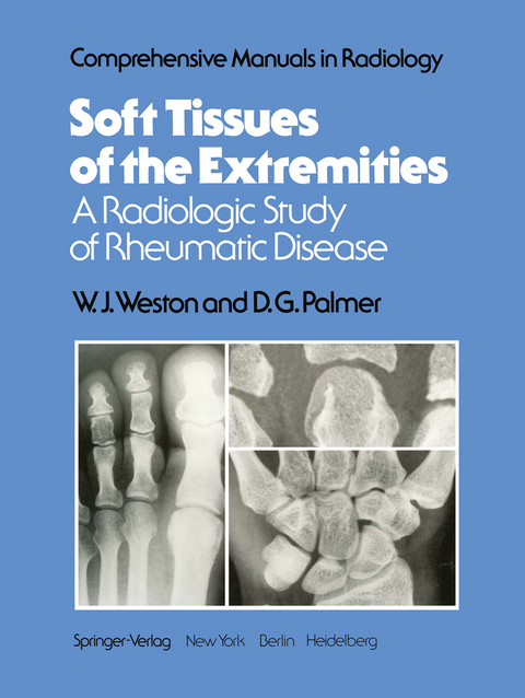 Soft Tissues of the Extremities - W. J. Weston, D. G. Palmer