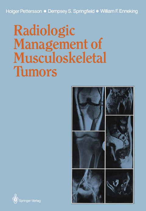 Radiologic Management of Musculoskeletal Tumors - Holger Pettersson, Dempsey S. Springfield, William F. Enneking