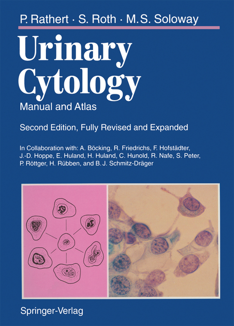 Urinary Cytology - Peter Rathert, Stephan Roth, Mark S. Soloway