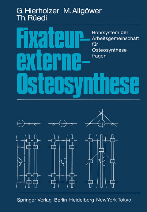 Fixateur-externe-Osteosynthese - G. Hierholzer, M. Allgöwer, Thomas Rüedi