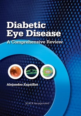 Diabetic Eye Disease - Alejandro Espaillat