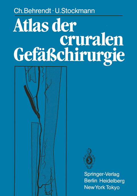Atlas der cruralen Gefäßchirurgie - Christina Behrendt, Ulf Stockmann