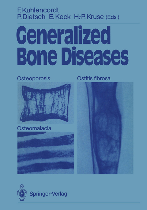 Generalized Bone Diseases - 