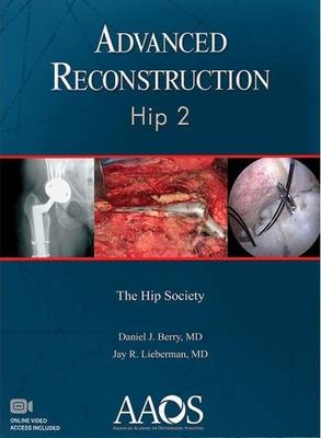 Advanced Reconstruction: Hip 2 - 
