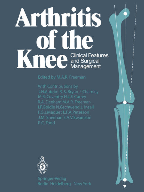 Arthritis of the Knee - 