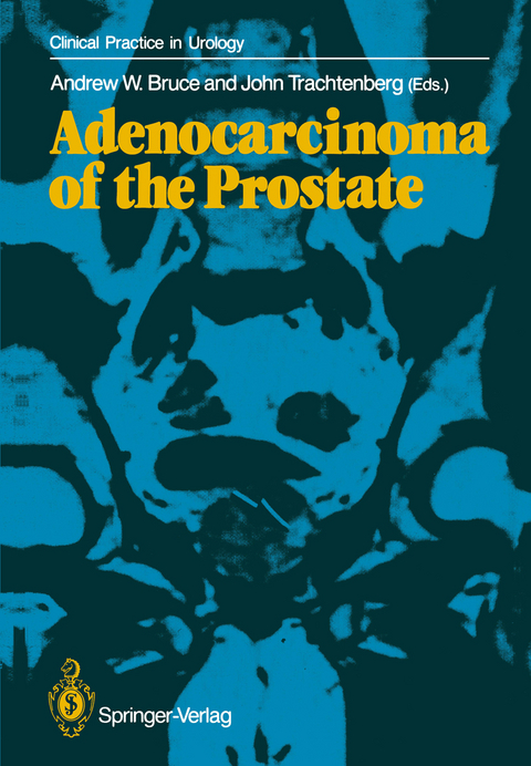 Adenocarcinoma of the Prostate - 