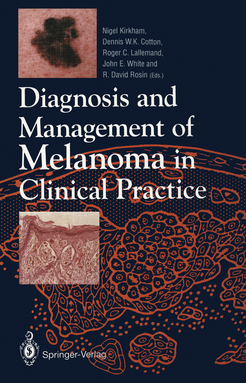 Diagnosis and Management of Melanoma in Clinical Practice - 