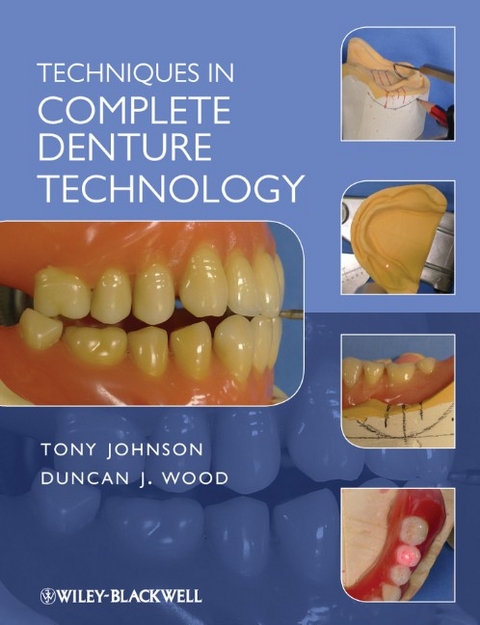 Techniques in Complete Denture Technology - Duncan J. Wood