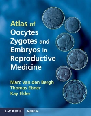 Atlas of Oocytes, Zygotes and Embryos in Reproductive Medicine Hardback with CD-ROM - Marc Van den Bergh, Thomas Ebner, Kay Elder