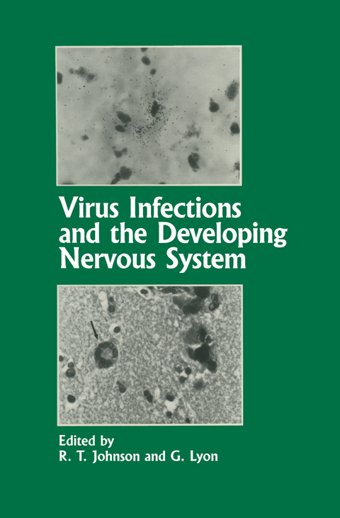 Virus Infections and the Developing Nervous System - 