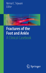 Fractures of the Foot and Ankle - 