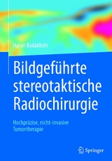 Bildgeführte stereotaktische Radiochirurgie - Harun Badakhshi