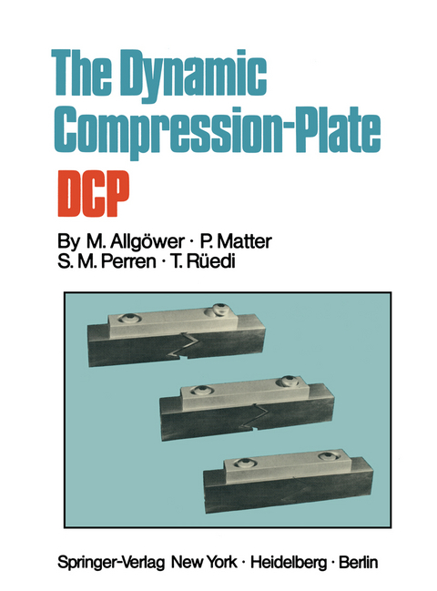 The Dynamic Compression Plate DCP - Martin Allgöwer, P. Matter, S.M. Perren, T. Rüedi