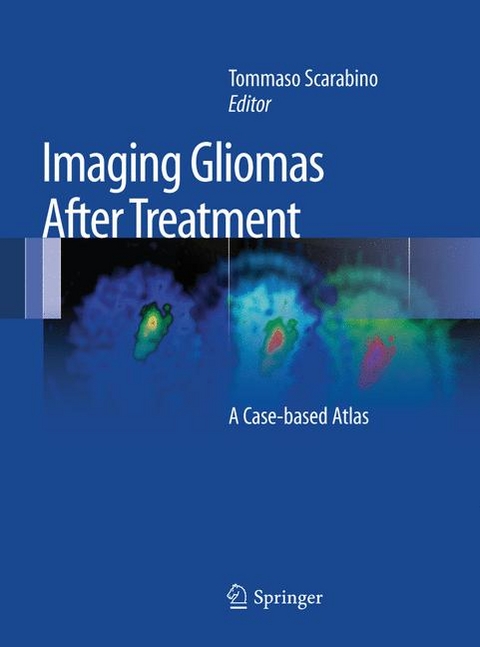 Imaging Gliomas After Treatment - 