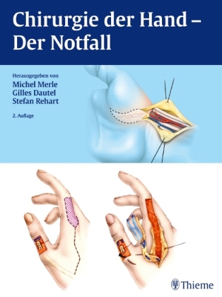 Chirurgie der Hand - Der Notfall - Michel Merle