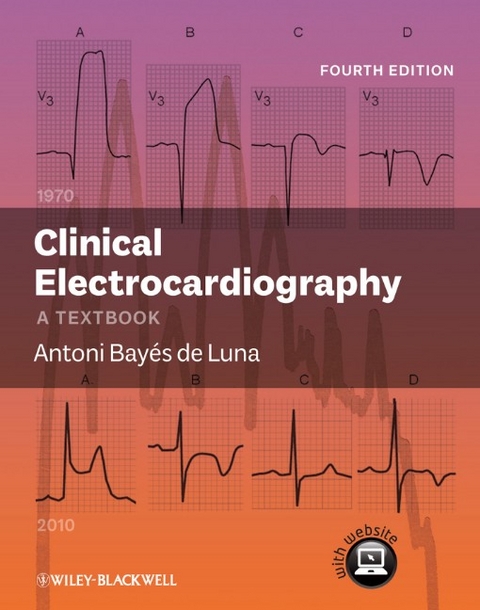 Clinical Electrocardiography - Antoni Bayes de Luna