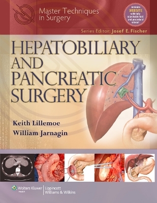 Master Techniques in Surgery: Hepatobiliary and Pancreatic Surgery - Keith Lillemoe, William Jarnagin