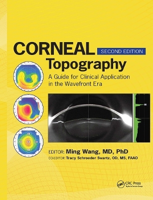 Corneal Topography - Ming Wang