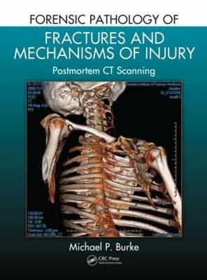 Forensic Pathology of Fractures and Mechanisms of Injury - Michael P. Burke