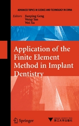 Application of the Finite Element Method in Implant Dentistry - 