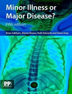 Minor Illness or Major Disease? -  Pharmaceutical Press, Alyson Brown, Ruth Edwards