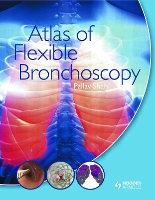 Atlas of Flexible Bronchoscopy - Pallav Shah