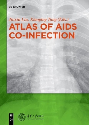 Atlas of AIDS Co-infection - 