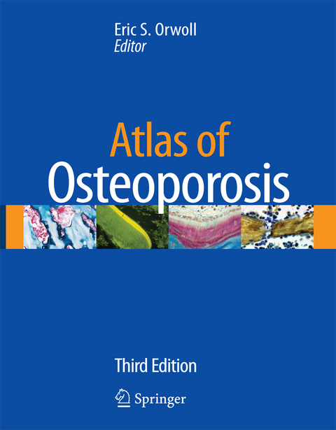 Atlas of Osteoporosis - 