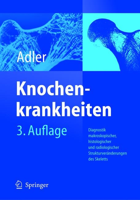 Knochenkrankheiten - Claus-Peter Adler