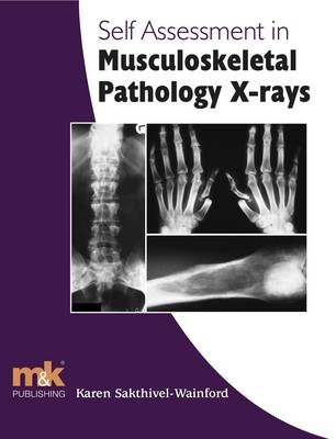 Self-assessment in Musculoskeletal Pathology X-rays - Karen Sakthivel-Wainford
