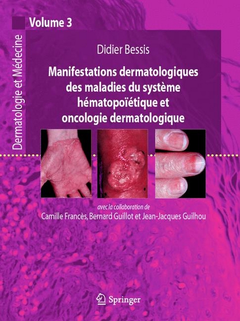 Manifestations Dermatologiques DES Maladies Du Systeme Hematopoietique ET Oncologie Dermatologique - Didier Bessis