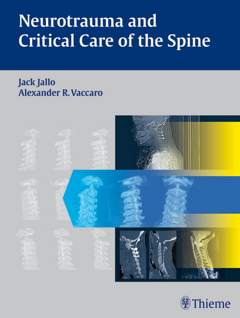 Neurotrauma and Critical Care of the Spine - 