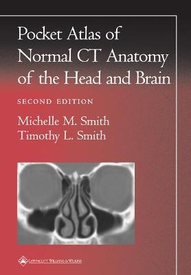 Pocket Atlas of Normal CT Anatomy of the Head and Brain - Michelle M. Smith, Timothy L. Smith