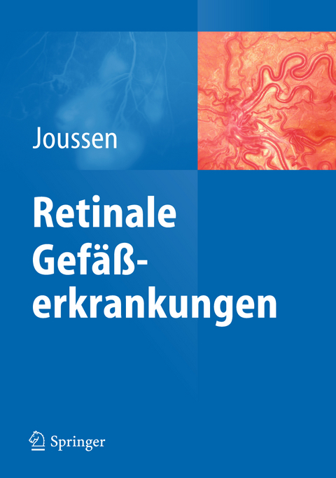 Retinale Gefäßerkrankungen - 