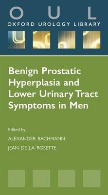 Benign Prostatic Hyperplasia and Lower Urinary Tract Symptoms in Men - 