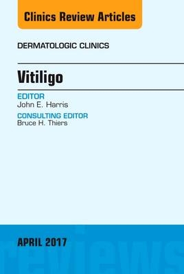 Vitiligo, An Issue of Dermatologic Clinics - John E. Harris