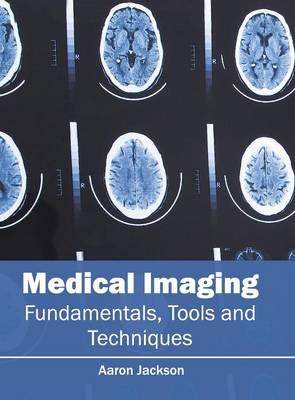 Medical Imaging: Fundamentals, Tools and Techniques - 