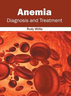 Anemia: Diagnosis and Treatment - 