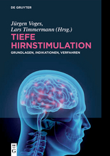 Tiefe Hirnstimulation - 