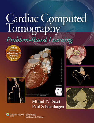 Cardiac Computed Tomography - 