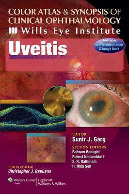 Color Atlas and Synopsis of Clinical Ophthalmology - Wills Eye Institute - Uveitis - Sunir J. Garg