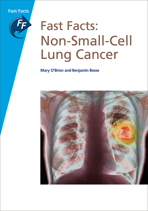 Fast Facts: Non-Small-Cell Lung Cancer - Mary O’Brien, Benjamin Besse