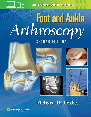 Foot & Ankle Arthroscopy - Richard D Ferkel