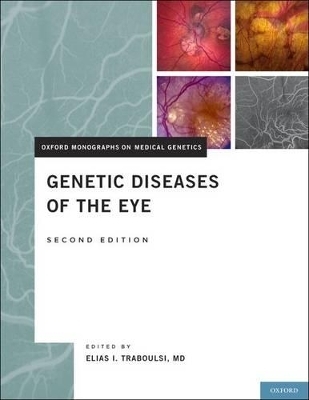 Genetic Diseases of the Eye - 