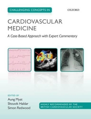 Challenging Concepts in Cardiovascular Medicine - 