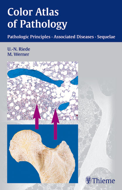 Color Atlas of Pathology - Ursus-Nikolaus Riede, Martin Werner