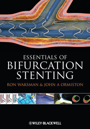 Bifurcation Stenting - Ron Waksman, John A. Ormiston
