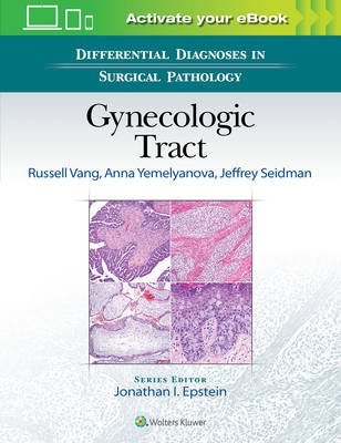 Differential Diagnoses in Surgical Pathology: Gynecologic Tract - Russell Vang, Anna Yemelyanova, Jeffrey D. Seidman