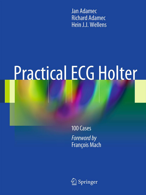 Practical ECG Holter - 